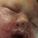 Photo: Georgia police threw a stun grenade in a 19-month-old's crib