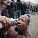 Baltimore Man Has His Eyes Cleaned