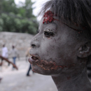 An Injured Person in Port-au-Prince