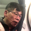 Photo: 'Just kill me': The moment bloodied United passenger mumbled about suicide after he was body-slammed by cops and dragged off overbooked flight to make room for airline STAFF